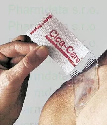 Cover Cica-Care na blizny keloidowe + nadciśnieniowe 6x12/1szt
