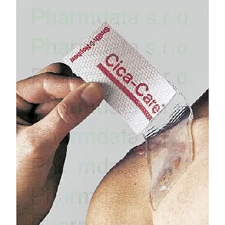 Krytí Cica-Care na keloid.+hypertr.jizvy 6x12/1ks